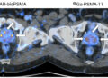 Registrational Phase III CLARIFY trial: Target number of participants achieved