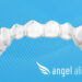 Paris Court Ruling on Discontinued Feature Will Have Minimal Impact on Angelalign Customers
