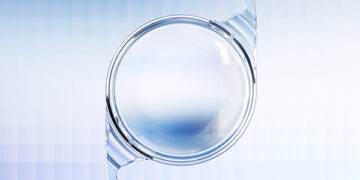 ZEISS announces availability of CT LUCIA 621P in Japan, expanding its broad ZEISS Cataract Workflow